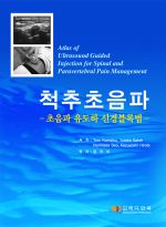 척추초음파 - 초음파 유도하 신경블록법-