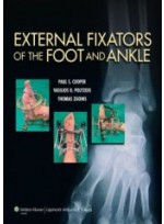 External Fixators of the Foot and Ankle