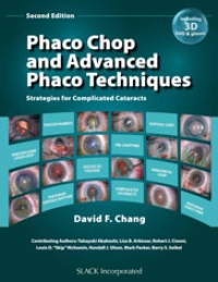 Phaco Chop and Advanced Phaco Techniques 