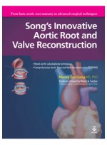 Song's Innovative Aortic Root and Valve Reconstruction