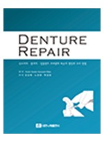 DENTURE REPAIR 