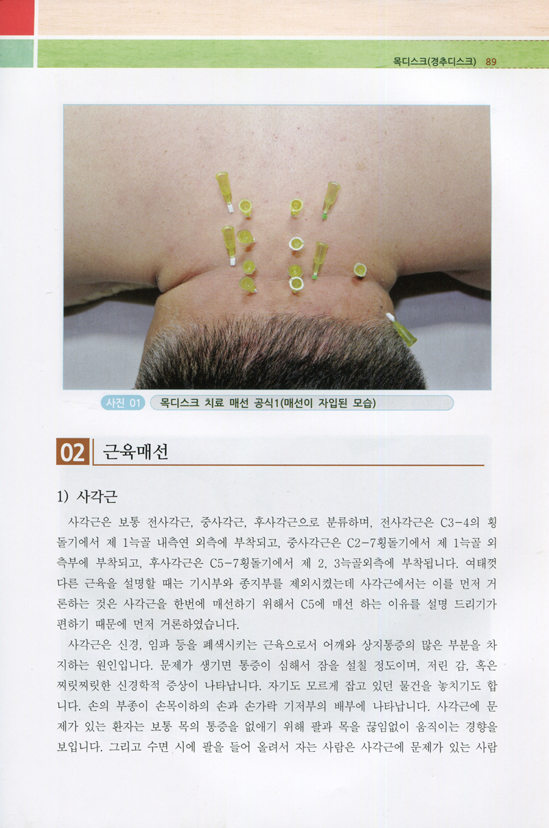 한의사를 위한 최강통증매선