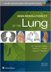 High-Resolution CT of the Lung, 5/e