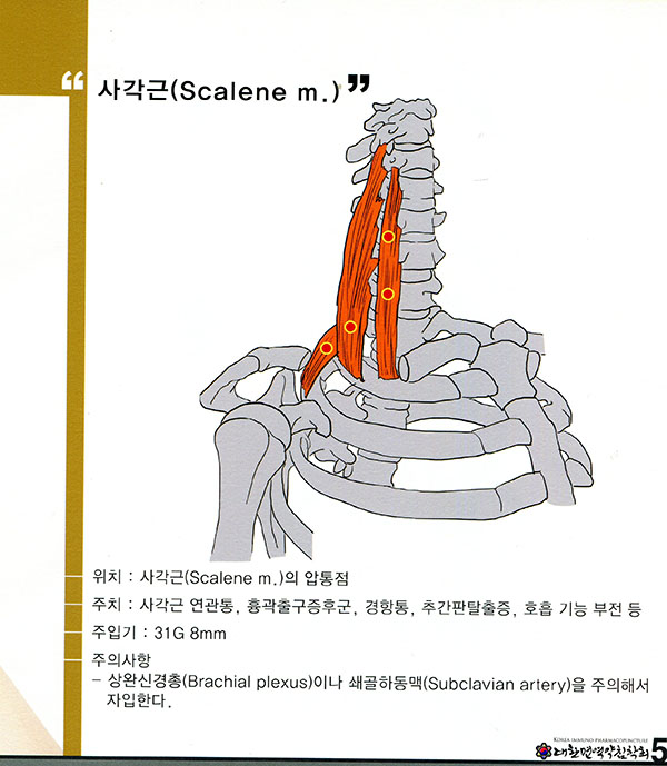 면역약침 취혈지침서