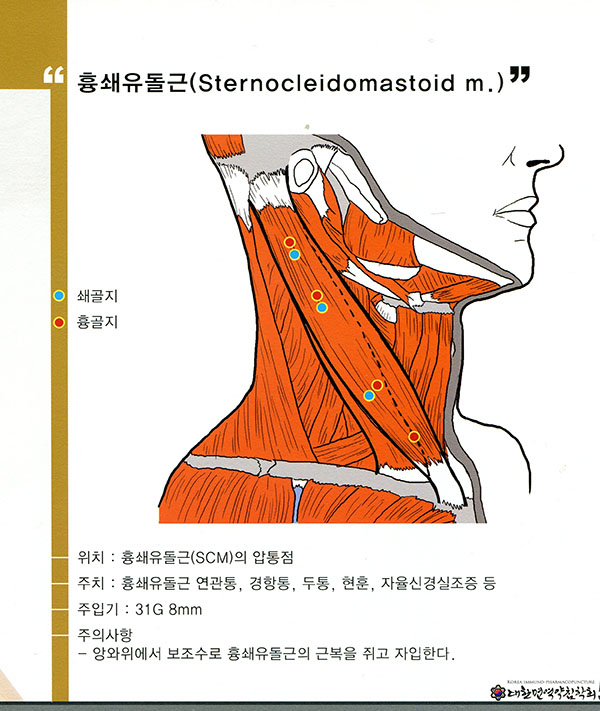 면역약침 취혈지침서