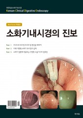 소화기내시경의 진보(Best Forum특별호)-Korean Clinical Digestive Endoscopy