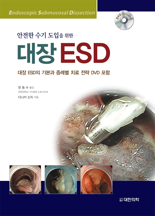 대장 ESD - 안전한 수기 도입을 위한 (DVD 포함)