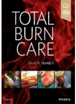 Total Burn Care, 5/e