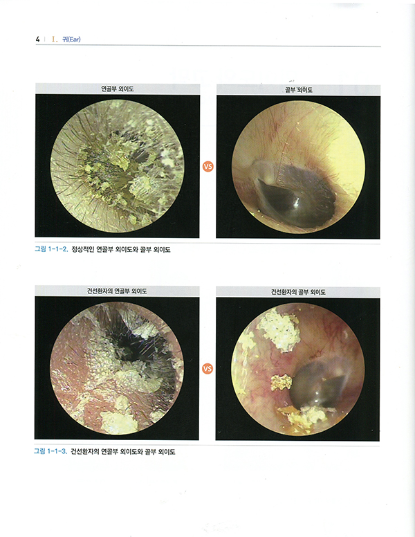 사진으로 공부하는 이비인후과학 (한의학)