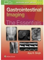 Gastrointestinal Imaging: The Essentials