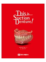 This is Suction Denture! 
