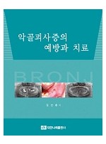 악골괴사증의 예방과 치료 