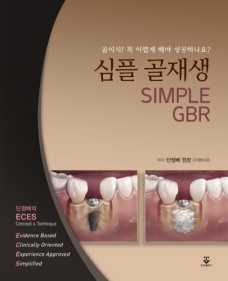 심플 골재생 (SIMPLE GBR)