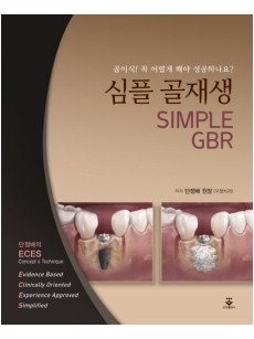 심플 골재생 (SIMPLE GBR)