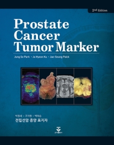 전립선암 종양 표지자 2판