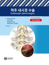 척추 내시경 수술 2/판 [원제: Endoscopic Spine Surgery, 2e] 