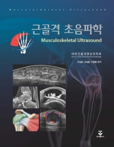 근골격 초음파학 (Musculoskeletal Ultrasound)