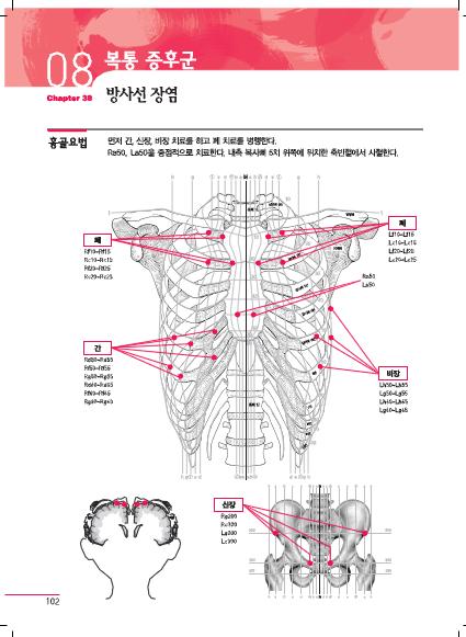 NEW 흔하지 않은 통증 증후군