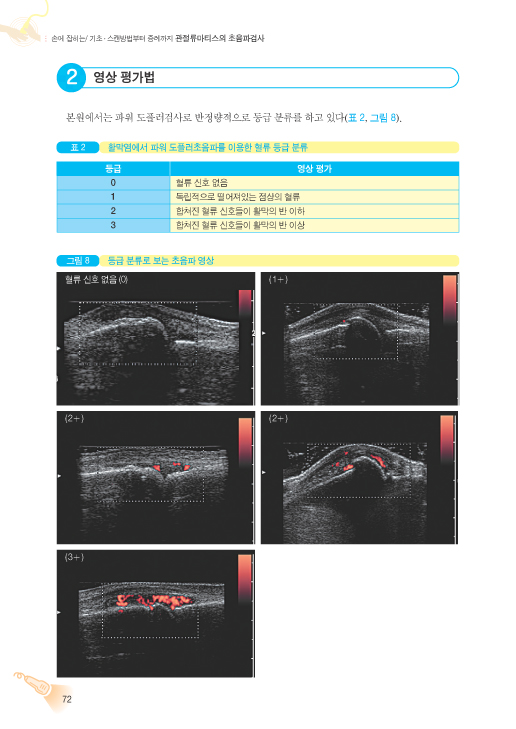 관절류마티스의 초음파검사 - 손에 잡히는 기초스캔방법부터 증례까지   