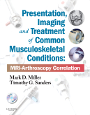 Presentation, Imaging and Treatment of Common Musculoskeletal Conditions Expert Consult