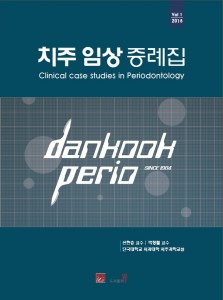 치주 임상 증례집 Clinical case studies in Periodontology