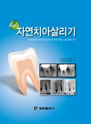 yes! 자연치아살리기- 비수술적 치주치료와 어려운 엔도 성공하기 