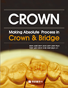 Making Absolute process in crown & bridge (개정3판)