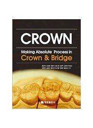 Making Absolute process in crown & bridge (개정3판)
