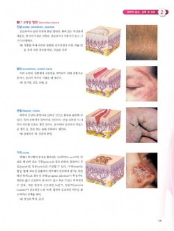 피부질환 아틀라스, 3판 