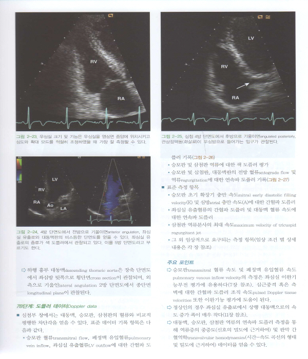 임상 심초음파 한 권으로 끝내기 Echocardiography Review Guide