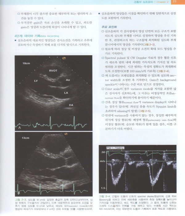 임상 심초음파 한 권으로 끝내기 Echocardiography Review Guide