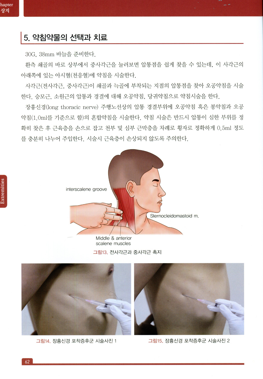 말초신경 약침의학