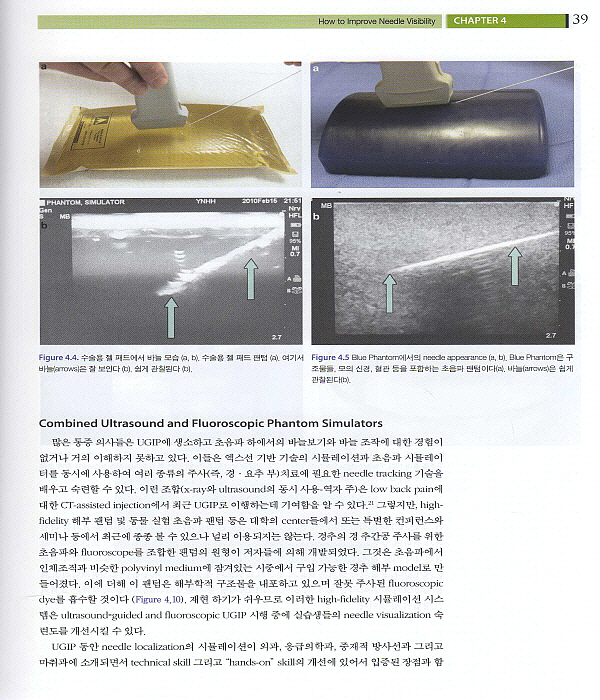 초음파를 이용한 척추와 말초신경 치료