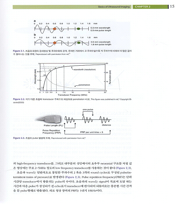 초음파를 이용한 척추와 말초신경 치료