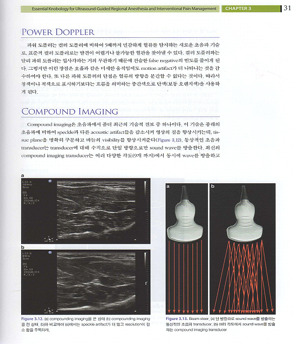 초음파를 이용한 척추와 말초신경 치료