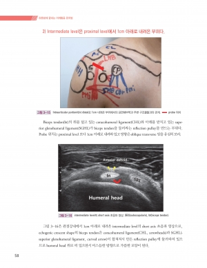 하룻밤에 끝내는 어깨통증 완치법