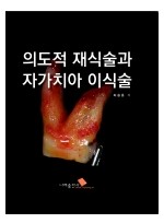 의도적 재식술과 자가치아이식술  