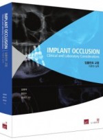 IMPLANT OCCLUSION Clinical and Laboratory Considerations 임플란트 교합 이론과 실제