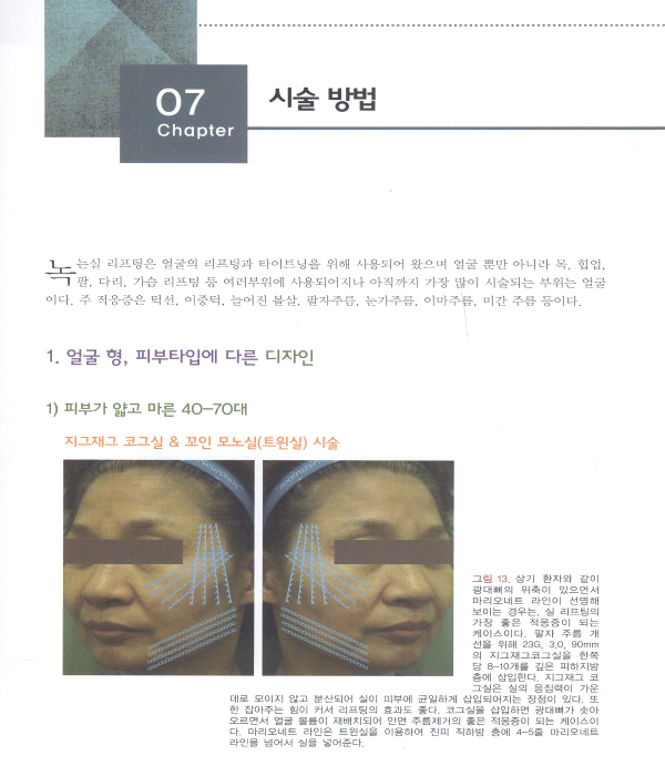 녹는실 리프팅의 정석-피부과 성형외과 전문의가 집필한 (DVD포함)