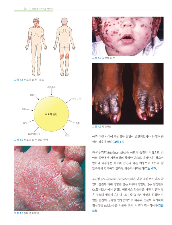 한번에 이해되는 피부과