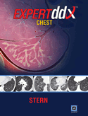 Expert Differential Diagnoses: Chest