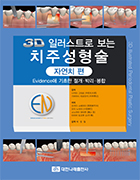 3D 일러스트로 보는 치주성형술-자연치편 