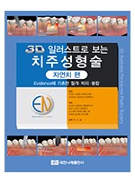 3D 일러스트로 보는 치주성형술-자연치편 