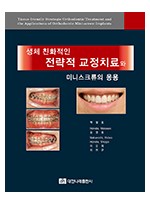 생체 친화적인 전략적 교정치료와 미니스크류의 응용 