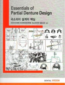 국소의치 설계의 핵심 Essentials of Partial Denture Design