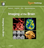 Imaging of the Brain, Expert Radiology Series 