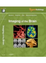 Imaging of the Brain, Expert Radiology Series 