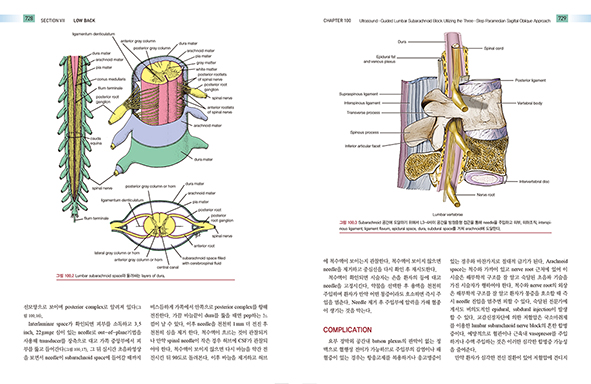 초음파를 이용한 통증치료- 그림과 사진으로 배우는 168가지 주사테크닉