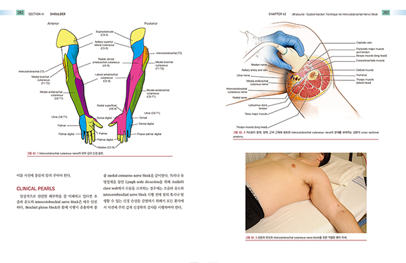 초음파를 이용한 통증치료- 그림과 사진으로 배우는 168가지 주사테크닉