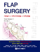 FLAP SURGERY(기본술식+치주조직재생술+치주성형술) 
